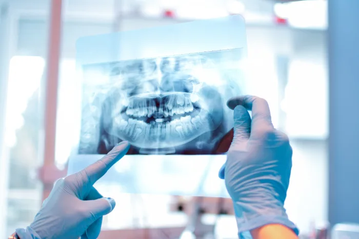 Des dents saines grâce à la technologie de scan buccal 3D
